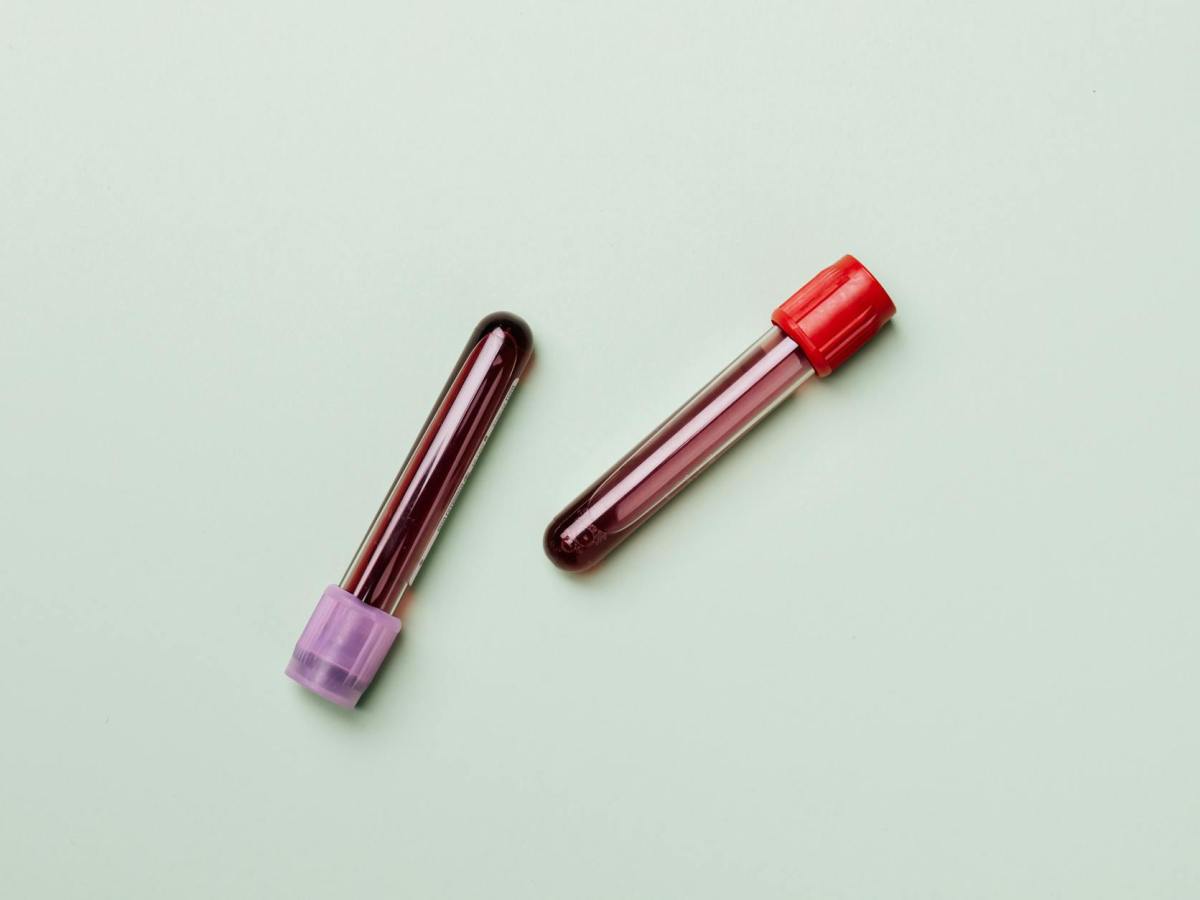 The Decannulation Room